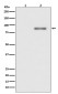 Phospho-PKC alpha (Thr638) Rabbit mAb ABZ5268