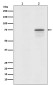 Phospho-Raf1 (Ser259) Rabbit mAb ABZ5269