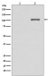 Phospho-IRE1 (Ser724) Rabbit mAb ABZ5270
