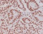 Phospho-CREB (Ser133) Rabbit mAb ABZ5271