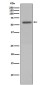 Phospho-Vimentin (Ser72) Rabbit mAb ABZ5272