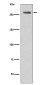 Phospho-LRRK2 (Ser395) Rabbit mAb ABZ5273