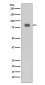 Phospho-HSF1 (Ser326) Rabbit mAb ABZ5274