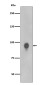 Phospho-RSK1 p90 (Thr359/Ser363) Rabbit mAb ABZ5275