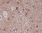 Phospho-PAK1/2/3 (Ser144/Ser141/Ser154) Rabbit mAb ABZ5276