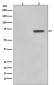 Phospho-ATF2 (Thr71) Rabbit mAb ABZ5283