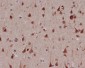 Phospho-MSK1 (Ser376) Rabbit mAb ABZ5285