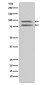 Phospho-MSK1 (Ser376) Rabbit mAb ABZ5285