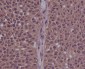 Phospho-CDK2 (Tyr15) Rabbit mAb ABZ5286