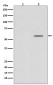 Phospho-Smad2 (Ser250) Rabbit mAb ABZ5287