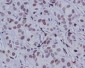 Phospho-c-Jun (Ser63) Rabbit mAb ABZ5290