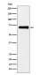 Phospho-PAK4/5/6 (Ser474/Ser560/Ser602) Rabbit mAb ABZ5291