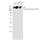 Phospho-GCN2 (Thr667) Rabbit mAb ABZ5295