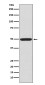 Phospho-PRKAR2A (Ser99) Rabbit mAb ABZ5296