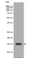 MonoMethyl-Histone H3 (Arg2) Rabbit mAb ABZ5300