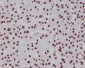 MonoMethyl-Histone H3 (Lys18) Rabbit mAb ABZ5301