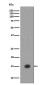MonoMethyl-Histone H3 (Lys18) Rabbit mAb ABZ5301
