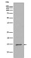 MonoMethyl-Histone H2B (Arg79) Rabbit mAb ABZ5302