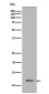 TriMethyl-Histone H4 (Lys20) Rabbit mAb ABZ5303