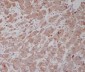 gamma Tubulin Rabbit mAb ABZ5304