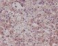 [KD]LRP1 Rabbit mAb ABZ5307