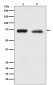 [KO]NF2/Merlin Rabbit mAb ABZ5309