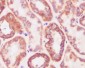 [KD]Prohibitin Rabbit mAb ABZ5310