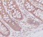 [KO]ATG7 Rabbit mAb ABZ5312