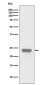 [KO]PARK7/DJ1 Rabbit mAb ABZ5316