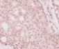 [KD]4E BP1 Rabbit mAb ABZ5319