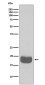 [KD]4E BP1 Rabbit mAb ABZ5319