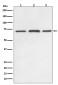 [KD]SDHA Rabbit mAb ABZ5320