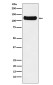 [KD]DDB1 Rabbit mAb ABZ5324