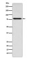 [KD]Coilin Rabbit mAb ABZ5325