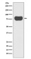 [KD]Cortactin Rabbit mAb ABZ5328