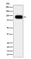 [KO]CD166 Rabbit mAb ABZ5329