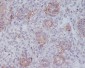 [KD]CD146 Rabbit mAb ABZ5334