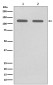 [KD]CD146 Rabbit mAb ABZ5334