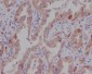 [KD]CTNNA1 Rabbit mAb ABZ5336