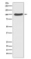 [KD]CTNNA1 Rabbit mAb ABZ5336