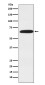 [KD]DDX5 Rabbit mAb ABZ5337