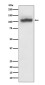 [KD]SERCA2 ATPase Rabbit mAb ABZ5338