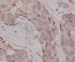 [KD]Hsc70 Rabbit mAb ABZ5340