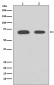 [KD]Chk2 Rabbit mAb ABZ5341