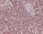 [KD]FUBP1/FBP Rabbit mAb ABZ5345