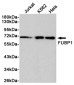 [KD]FUBP1/FBP Rabbit mAb ABZ5345